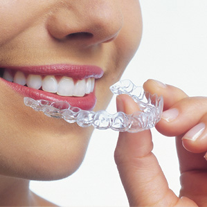 invisalign